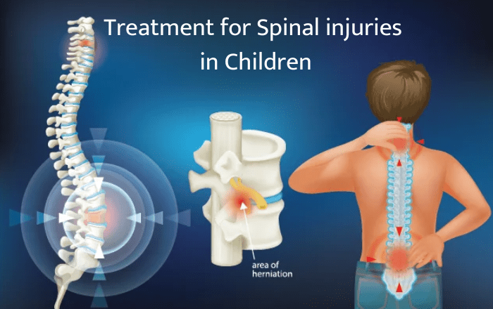Treatment for spinal injuries in children