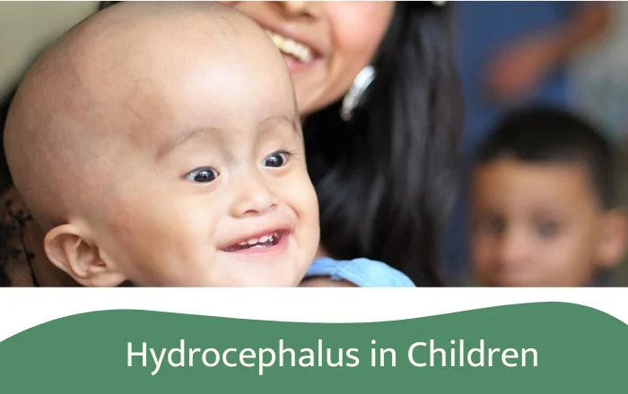 Hydrocephalus in Children: Causes, Symptoms, and Modern Treatments