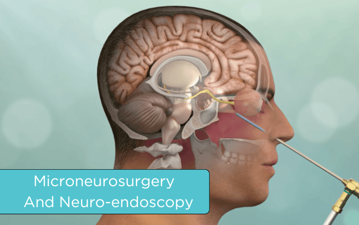 Microneurosurgery & Neuro-endoscopy in Mumbai & Thane