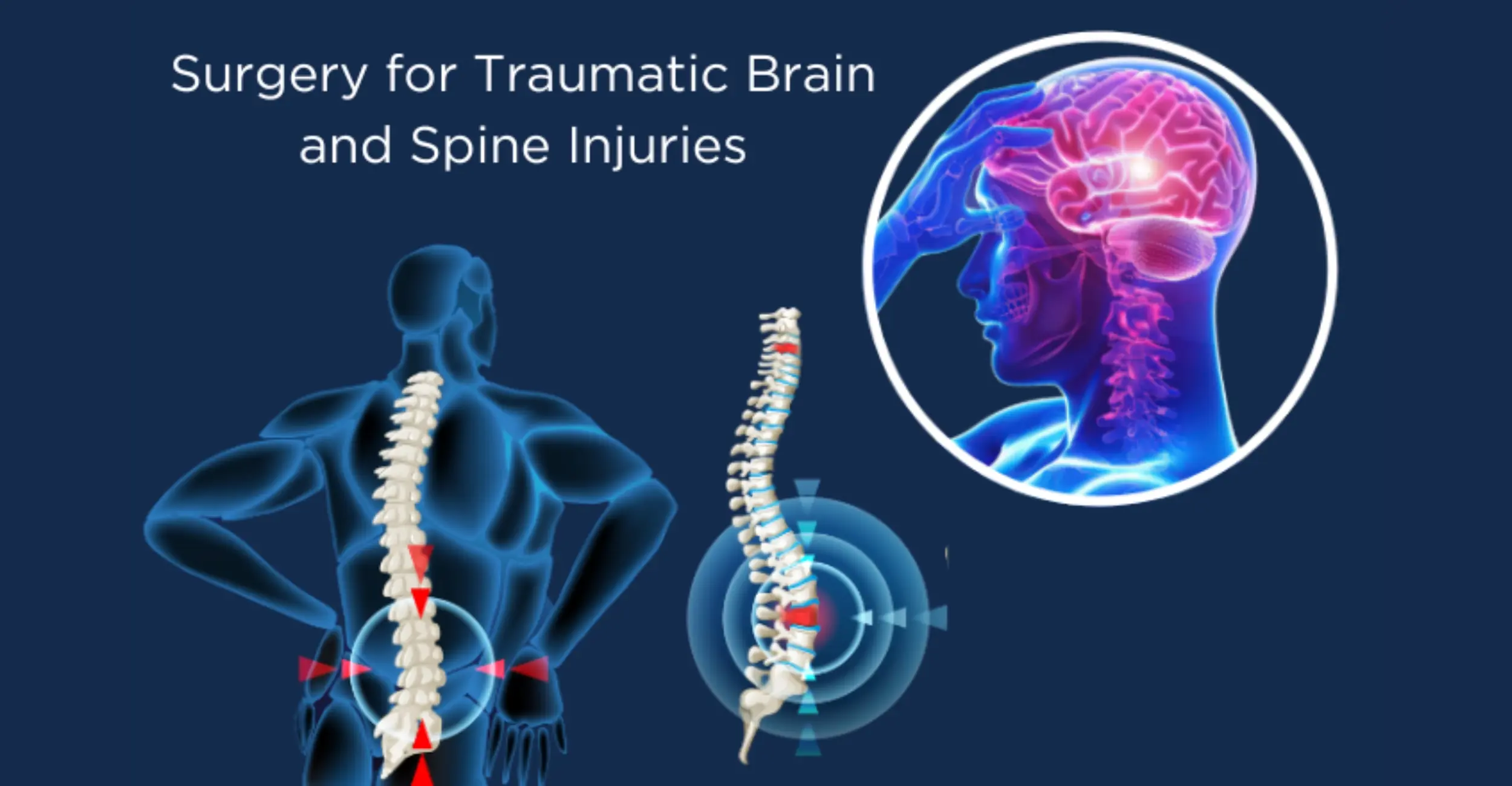 Expert Surgery for Traumatic Brain & Spine Injuries in Mumbai
