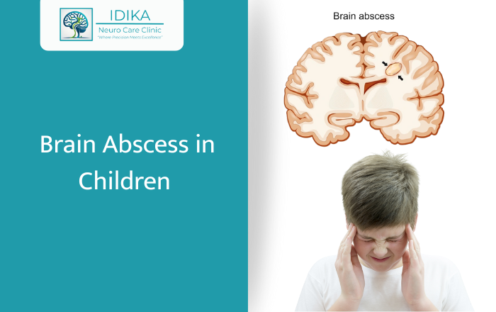 Brain Abscess in Children: Symptoms & Treatment