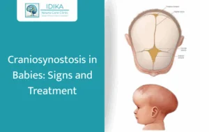 Craniosynostosis in Babies: Signs, Causes, and Treatment