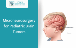 What Is Microneurosurgery for Pediatric Brain Tumors?