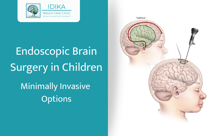 Endoscopic Brain Surgery in Children: Minimally Invasive Options