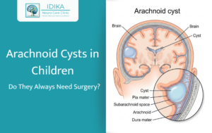 Arachnoid Cysts in Children: Do They Always Need Surgery?